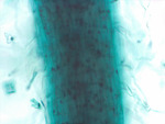 MISSING THUMBNAIL